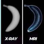 MRI VS CT VS X-RAY