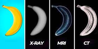 MRI VS CT VS X-RAY